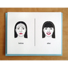 Botox Bangs Card - Cards